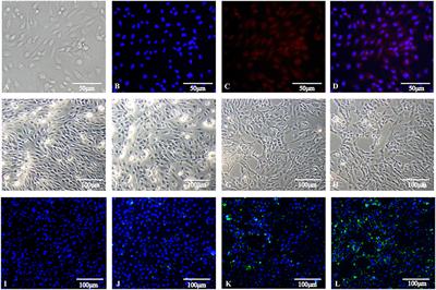 Identification of Differentially Expressed Non-coding RNA Networks With Potential Immunoregulatory Roles During Salmonella Enteritidis Infection in Ducks